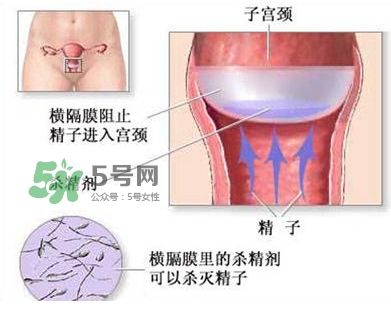 殺精劑避孕可靠嗎？殺精劑避孕要注意什么？