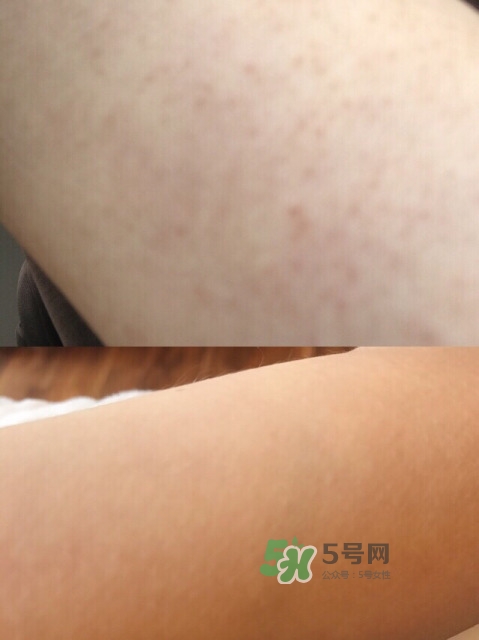 去雞皮膚產品怎么選擇 去雞皮膚產品使用步驟