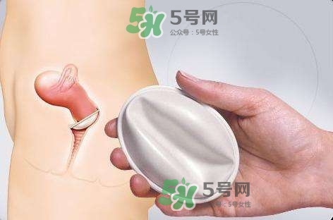 使用殺精劑避孕失敗孩子能要嗎？殺精劑避孕的不良反應(yīng)