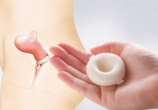 殺精劑有什么副作用？殺精劑的使用方法