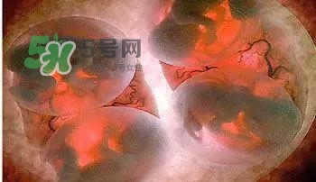多胞胎是怎么生產(chǎn)的？多胞胎應(yīng)選擇什么分娩方式