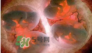 多胞胎順產(chǎn)怎么生？多胞胎剖腹產(chǎn)和單胎剖腹產(chǎn)的區(qū)別