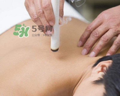 艾灸器具哪種好？艾灸后皮膚極癢為什么