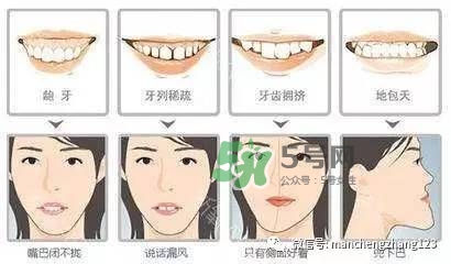 乳牙齲齒要不要補(bǔ)？乳牙齲齒怎么辦？