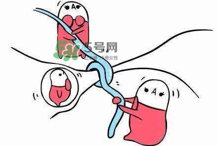 結(jié)扎好還是上環(huán)好？結(jié)扎上環(huán)哪個(gè)危害??？