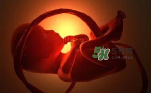 寶寶臍帶繞頸只能剖腹產(chǎn)嗎？胎兒臍帶繞頸孕婦有什么感覺(jué)