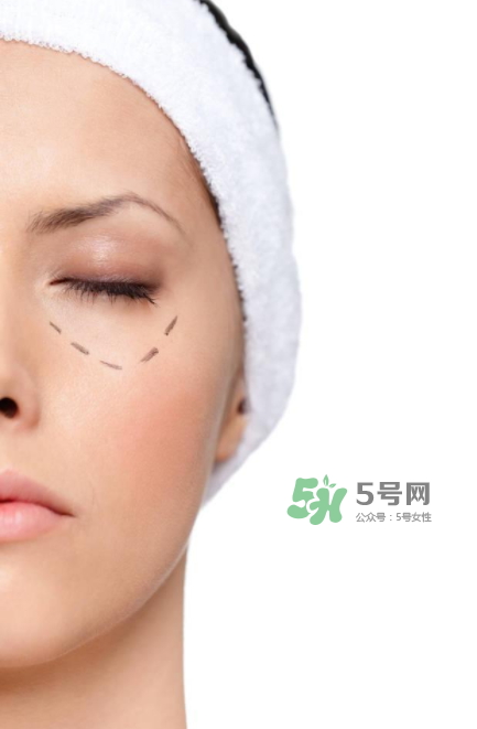 近視手術(shù)多少度不能做？多少度可以做近視手術(shù)？