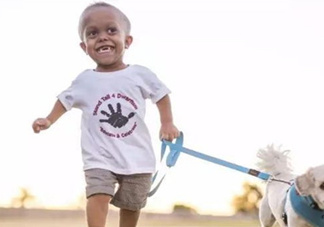 侏儒癥遺傳嗎？侏儒癥在嬰幼兒期有何表現(xiàn)？