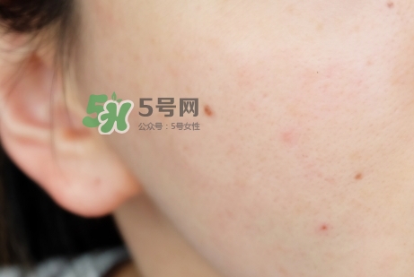 臘梅是什么牌子？臘梅是什么護(hù)膚品