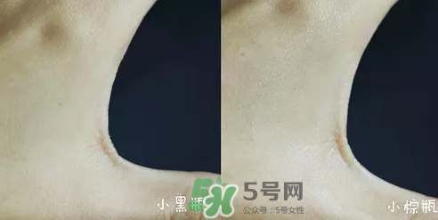 小黑瓶和小棕瓶可以一起用嗎？小棕瓶和小黑瓶哪個(gè)先用