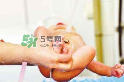 羊水栓塞是醫(yī)療事故嗎？羊水栓塞多發(fā)生于順產(chǎn)還是剖腹產(chǎn)？