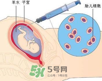 羊水栓塞是怎么回事？羊水栓塞怎么預(yù)防？
