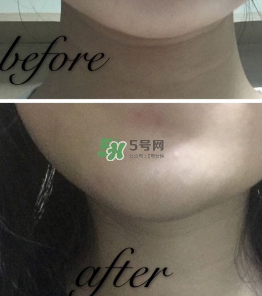 olay小白瓶有哪些版本？olay小白瓶版本區(qū)別