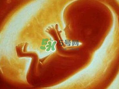 臍帶繞頸是什么原因造成的？臍帶繞頸是多休息還是多運動？