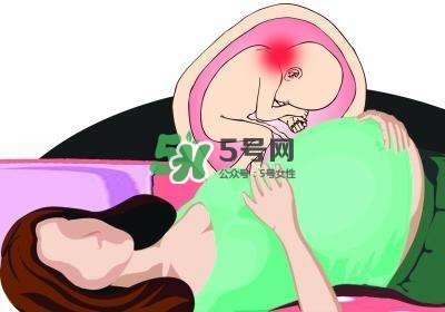 孕婦左側(cè)臥睡不著怎么辦？孕期左側(cè)睡不舒服怎么辦？