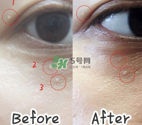 tsubu night pack去脂肪粒眼霜怎么用_說明書 tsubu night pack去脂肪粒眼霜怎么用_說明書