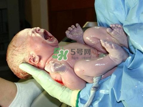 順產(chǎn)有多疼？順產(chǎn)的疼痛可以忍受嗎？