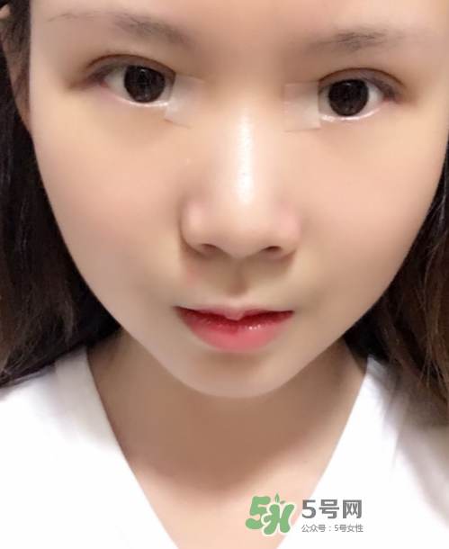 美皮護(hù)去疤效果怎么樣？美皮護(hù)有用嗎？