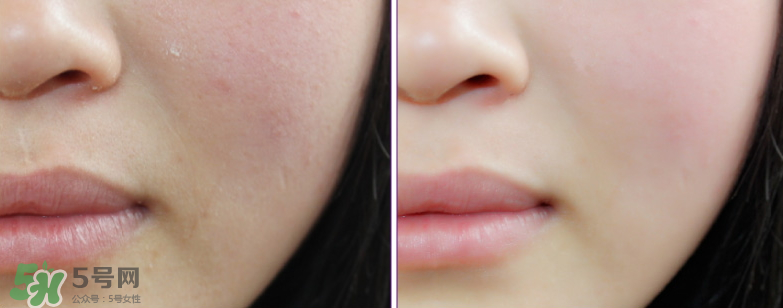 伽優(yōu)氣墊多少錢？伽優(yōu)氣墊適合什么年齡？