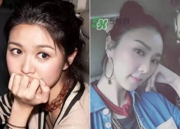 發(fā)際線低怎么調(diào)整？標(biāo)準(zhǔn)的發(fā)際線圖片