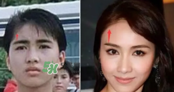 發(fā)際線低怎么調(diào)整？標(biāo)準(zhǔn)的發(fā)際線圖片