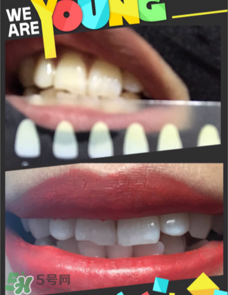 碧緹福美牙儀有副作用嗎？碧緹福美牙儀副作用是什么？