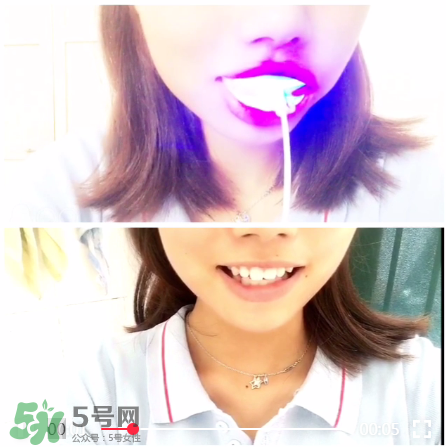 美牙儀能治氟斑牙嗎？氟斑牙可以用美白儀嗎？