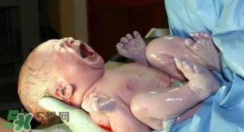 剪臍帶時(shí)寶寶會(huì)不會(huì)疼？剪臍帶寶寶疼嗎？