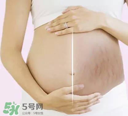 長(zhǎng)妊娠紋的前兆 長(zhǎng)妊娠紋很癢怎么辦？
