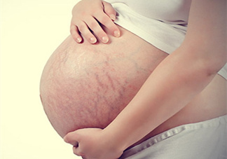 孕婦胸部長妊娠紋嗎？胸部長妊娠紋了怎么辦？