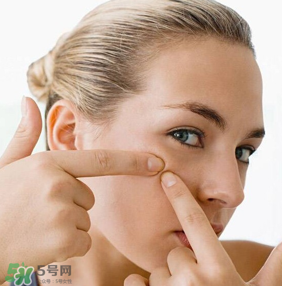 長(zhǎng)痘長(zhǎng)閉口怎么辦？長(zhǎng)痘長(zhǎng)閉口是什么原因？