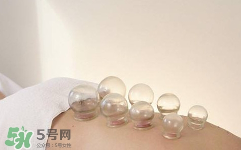 真空拔罐有用嗎？真空拔罐多長時(shí)間合適