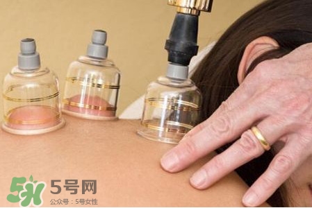 真空拔罐有用嗎？真空拔罐多長時(shí)間合適
