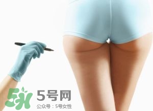 吸脂減肥副作用有哪些？吸脂減肥可靠嗎？