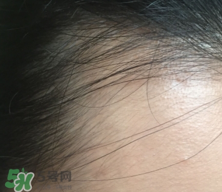 發(fā)際線粉要卸妝嗎_怎么卸？