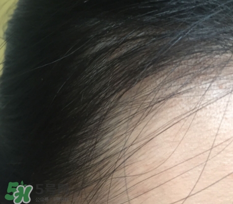 發(fā)際線粉要卸妝嗎_怎么卸？