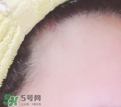 發(fā)際線粉哪個(gè)牌子好？