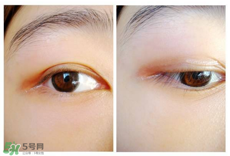 網(wǎng)紅雙眼皮貼大推薦？雙眼皮貼正確貼法