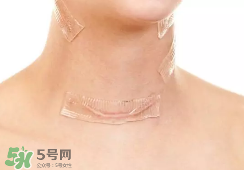 硅膠疤痕貼有用嗎？硅膠疤痕貼效果怎么樣？