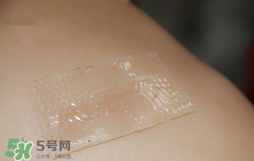 仙卡疤痕貼有用嗎？仙卡疤痕貼效果怎么樣？