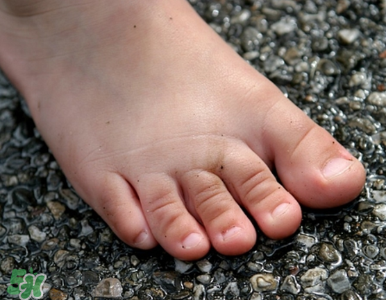 日本灰指甲藥水有用嗎？日本灰指甲藥水評(píng)測(cè)