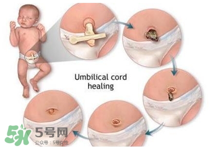 寶寶臍帶什么時候脫落？寶寶臍帶脫落后怎么護理？