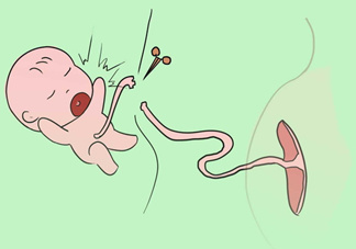 寶寶臍帶什么時候脫落？寶寶臍帶脫落后怎么護理？