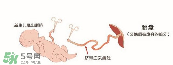 臍帶血有必要保存嗎？臍帶血有什么用？