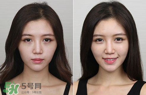 蘋果肌怎么化？蘋果肌究竟哪里好？