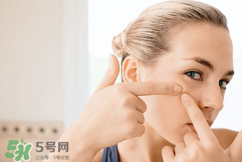 暗瘡可以擠壓嗎？油性和骯臟肌膚會(huì)容易有暗瘡嗎？