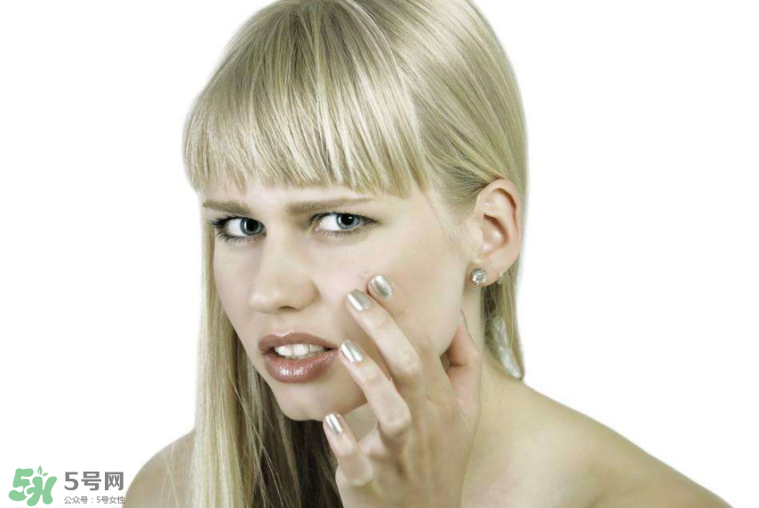 痤瘡和毛囊炎一樣嗎？痤瘡與毛囊炎區(qū)別