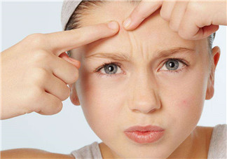 暗瘡可以擠壓嗎？油性和骯臟肌膚會容易有暗瘡嗎？