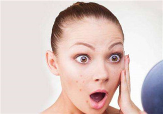 痘痘是如何形成的？食物祛痘法