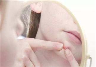 痤瘡和毛囊炎一樣嗎？痤瘡與毛囊炎區(qū)別